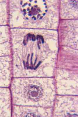  DNA Ist Kondensiert in Welchen Phasen?
