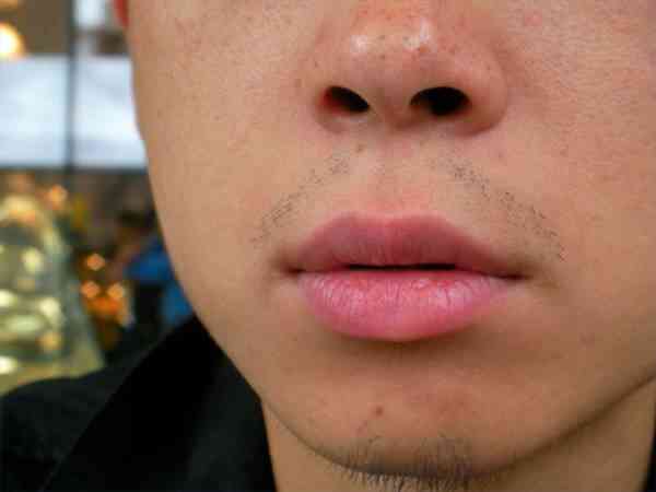 Chronischen Sinusitis-Symptome: Balance-Vision-Probleme