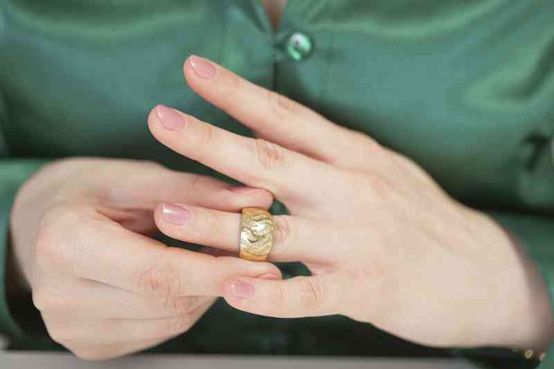 Was Macht Man Wenn Man Einen Ring Am Strand Verliert Wie man einen Ring aus einem geschwollene Finger