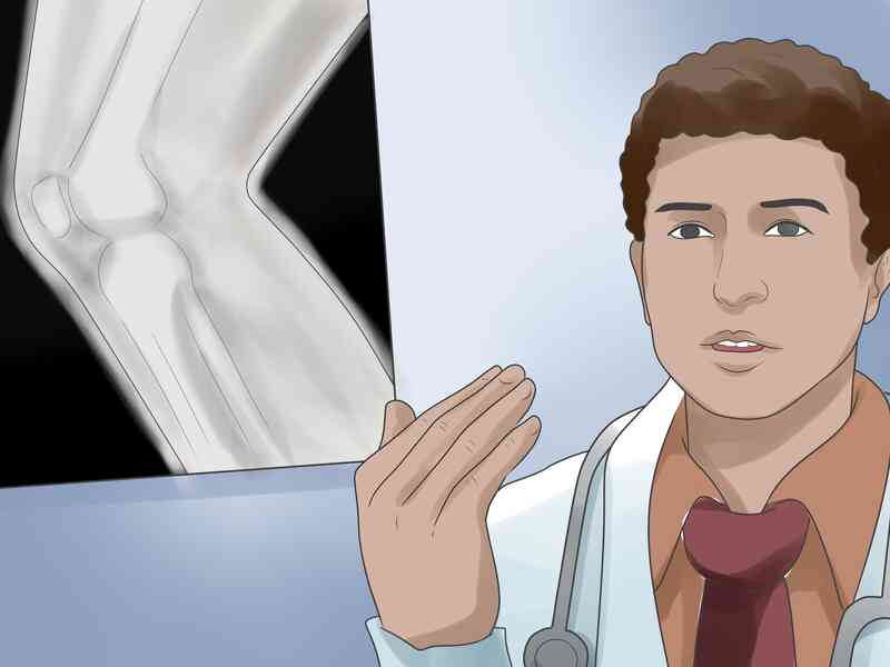 How to Deal mit einer Knie-Verstauchung